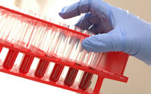 blood test tubes (haematology).jpg