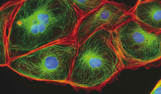 Transitional arrangements to the 2021 GMC-approved curricula for the Cellular Pathology Specialties Dr Clair Evans, Cellular Pathology CSTC Chair, Joanne Brinklow, Director of Learning, Jenny Maginley, Training Manager, Sandra Dewar-Creighton, Assessment Manager